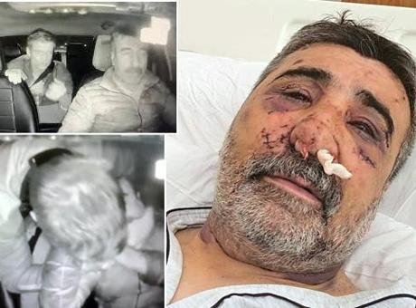 İngiliz boksörün dehşeti yaşattığı taksici konuştu: Ellerini gözüme sokmaya, ısırmaya, öpmeye başladı
