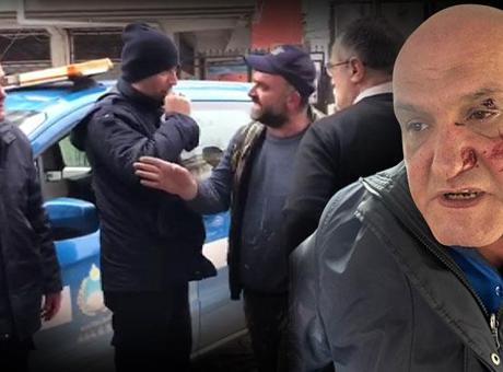 Kaldırım parkı kavgası! Zabıta memuruna yumruklu saldırı: Hastanelik oldu